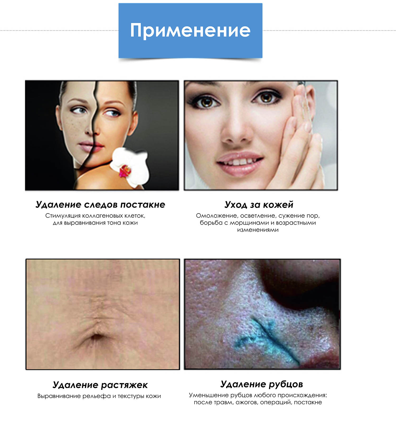 Области приминения
